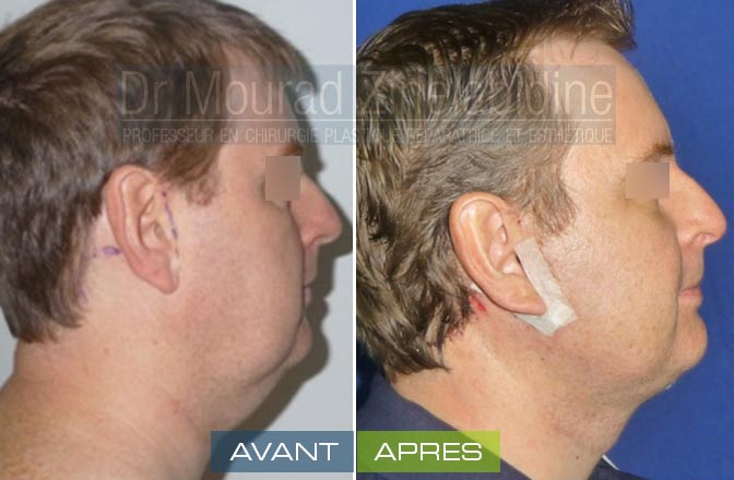 Les masques du miel sur la personne le profit le dommage