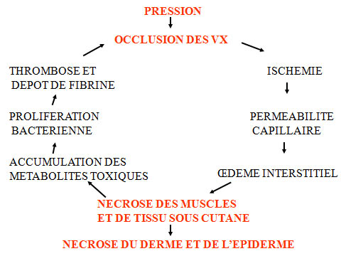 escarres de decubitus en Tunisie